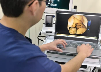 Cápsula endoscópica del IMSS graba el interior del tubo digestivo para agilizar diagnósticos