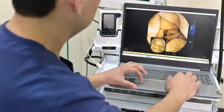 Cápsula endoscópica del IMSS graba el interior del tubo digestivo para agilizar diagnósticos