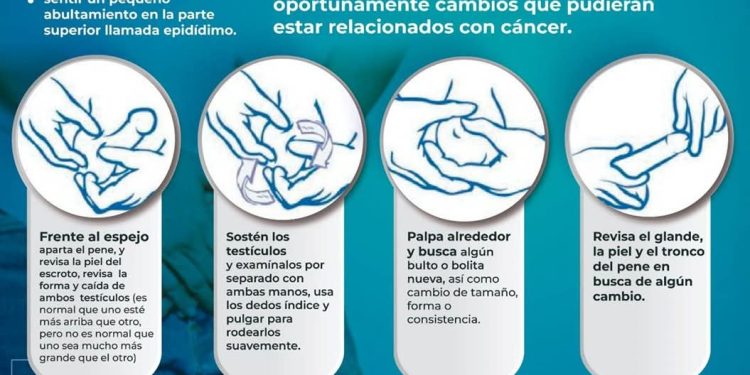 Exhorta IMSS Colima a hombres a prevenir cáncer testicular con autoexploración