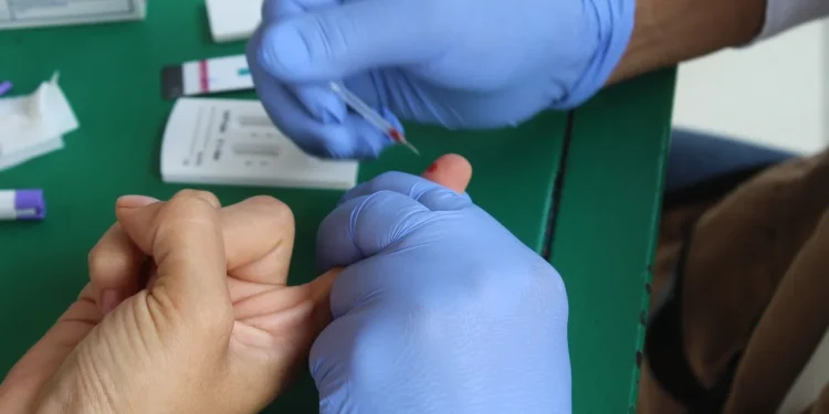 Tienen control virológico 95% de pacientes con VIH en el estado: Salud Colima