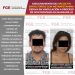 FGE. Aseguramiento de más de 170 envoltorios con metanfetamina deriva en vinculación a proceso de dos personas en Manzanillo